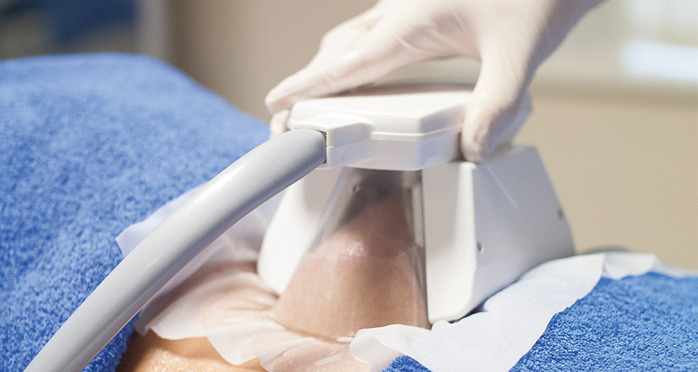 How Fat Freezing and HIFU Work Together? 2 Multiple Areas in One Session HIFU and Fat Freezing Warwickshire